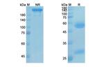 PD-1 (CD279) (Sintilimab Biosimilar) Antibody in SDS-PAGE (SDS-PAGE)