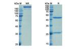 IL1RL2 (Spesolimab Biosimilar) Recombinant Humanized mouse Monoclonal Antibody