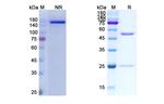 Toripalimab Humanized Antibody in SDS-PAGE (SDS-PAGE)