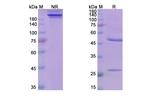 Mezagitamab Humanized Recombinant Human Monoclonal Antibody