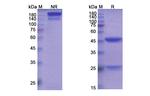 TIM-3 (Cobolimab Biosimilar) Antibody in SDS-PAGE (SDS-PAGE)