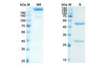 Levilimab Chimeric Antibody in SDS-PAGE (SDS-PAGE)