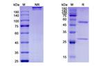 IL-33 (Etokimab Biosimilar) Recombinant Humanized mouse Monoclonal Antibody
