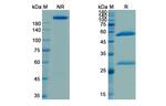 Naxitamab Humanized Recombinant Human Monoclonal Antibody