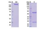 Donanemab Humanized Recombinant Human Monoclonal Antibody