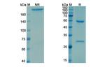 Teclistamab Chimeric Antibody in SDS-PAGE (SDS-PAGE)