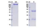 Complement C5 (Pozelimab Biosimilar) Recombinant Human Monoclonal Antibody
