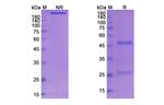 Serclutamab Chimeric Antibody in SDS-PAGE (SDS-PAGE)
