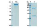 Elipovimab Antibody in SDS-PAGE (SDS-PAGE)