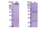 Volagidemab Recombinant Human Monoclonal Antibody