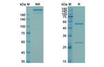Cendakimab Humanized Antibody in SDS-PAGE (SDS-PAGE)