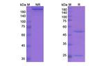 Garadacimab Humanized Recombinant Human Monoclonal Antibody