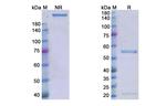 Magrolimab Chimeric Antibody in SDS-PAGE (SDS-PAGE)