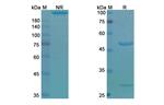 Ieramilimab Humanized Antibody in SDS-PAGE (SDS-PAGE)
