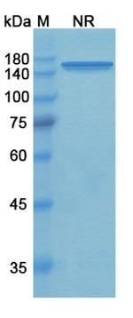Tidutamab Chimeric Antibody in SDS-PAGE (SDS-PAGE)