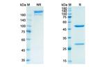 Semorinemab Chimeric Antibody in SDS-PAGE (SDS-PAGE)