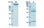 Bedinvetmab Antibody in SDS-PAGE (SDS-PAGE)