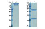 Relfovetmab Recombinant Feline Monoclonal Antibody