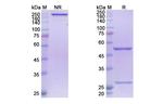 Atoltivimab Recombinant Human Monoclonal Antibody
