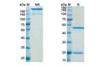 Quetmolimab Chimeric Recombinant Human Monoclonal Antibody