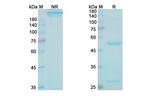 alpha Synuclein (Cinpanemab Biosimilar) Antibody in SDS-PAGE (SDS-PAGE)