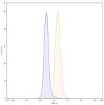 Disitamab Humanized Recombinant Human Monoclonal Antibody