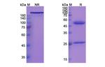 Disitamab Humanized Antibody in SDS-PAGE (SDS-PAGE)