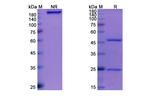 Amivantamab Antibody in SDS-PAGE (SDS-PAGE)