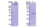 Astegolimab Antibody in SDS-PAGE (SDS-PAGE)