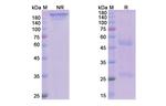 Avdoralimab Recombinant Human Monoclonal Antibody