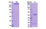Avizakimab Humanized Recombinant Human Monoclonal Antibody