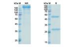 Befovacimab Humanized Antibody in SDS-PAGE (SDS-PAGE)