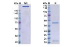 PD-L1 (CD274) (Cosibelimab Biosimilar) Antibody in SDS-PAGE (SDS-PAGE)