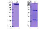 Dovanvetmab Antibody in SDS-PAGE (SDS-PAGE)