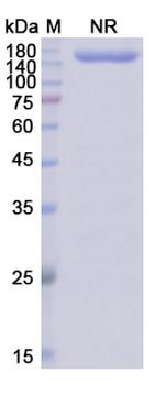 Epcoritamab Chimeric Antibody in SDS-PAGE (SDS-PAGE)