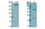 CD52 (Gatralimab Biosimilar) Recombinant Human Monoclonal Antibody