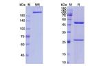 Ivuxolimab Antibody in SDS-PAGE (SDS-PAGE)