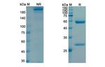 Lodapolimab Recombinant Human Monoclonal Antibody