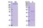 Manelimab Antibody in SDS-PAGE (SDS-PAGE)