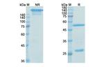 Mavezelimab Humanized Antibody in SDS-PAGE (SDS-PAGE)