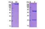 Mirzotamab Chimeric Antibody in SDS-PAGE (SDS-PAGE)