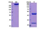 Odronextamab Recombinant Human Monoclonal Antibody