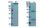 CD166 (ALCAM) (Praluzatamab Biosimilar) Antibody in SDS-PAGE (SDS-PAGE)