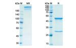 Retifanlimab Chimeric Recombinant Human Monoclonal Antibody