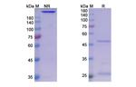 Sasanlimab Humanized Recombinant Human Monoclonal Antibody