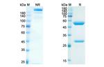 Serplulimab Humanized Recombinant Human Monoclonal Antibody