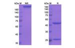 PCSK9 (Tafolecimab Biosimilar) Recombinant Human Monoclonal Antibody