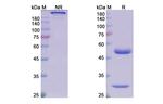 Tilvestamab Humanized Antibody in SDS-PAGE (SDS-PAGE)