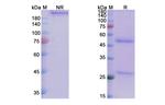 Tinurilimab Humanized Antibody in SDS-PAGE (SDS-PAGE)