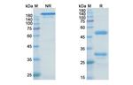 Tau (Zagotenemab Biosimilar) Antibody in SDS-PAGE (SDS-PAGE)
